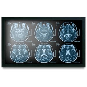 Onyx MEDDP-622HNN 21.5" Medical Display